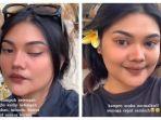 viral-cerita-wanita-terkena-bells-palsy-diduga-karena-sering-pakai-kipas-angin-dekat-wajah.jpg