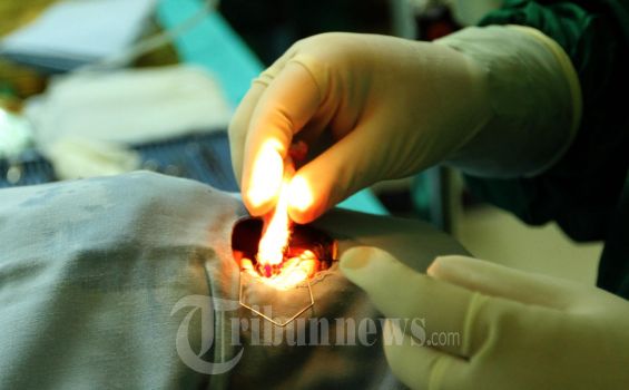 Operasi Katarak se-Kaltara Digelar di Nunukan