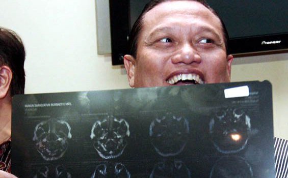 Adnan Pertanyakan KPK yang Belum Dekati Adang Dorodjatun