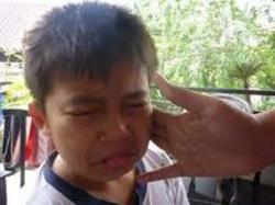 Tidak Bisa Menyanyi Siswa SDN Ditampar Wali Kelasnya