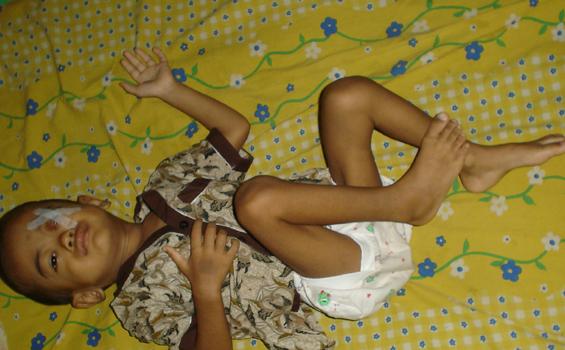 Tak Kunjung Sembuh Dirongrong Tumor, Tolonglah Bocah Ini