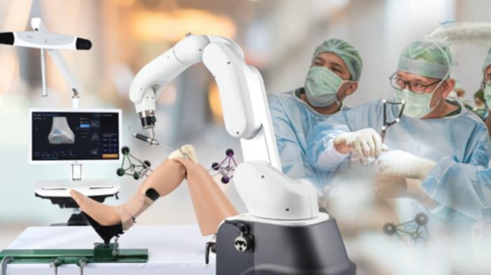 Ilustrasi bedah robotik (DOK. Tzu Chi Hospital PIK)