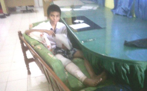 Ray Tetap Ikut UN Meski Kaki Kiri Patah
