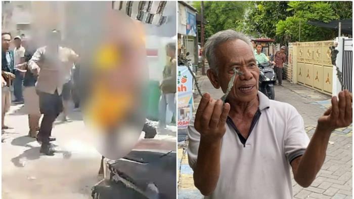 Sosok Rizki, Viral Pencuri Terbakar di Surabaya, Berawal Petugas Lepaskan Ikatan Pakai Korek Api