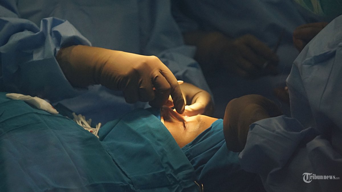 Tenaga kesehatan melakukan Operasi Kelopak Mata di JEC Eye Hospital Menteng  Jakarta Pusat, Sabtu (11/5/2024). JEC Eye Hospitals and Clinics menggagas Bakti Sosial Operasi Kelopak Mata berupa pemberian 30 tindakan operasi kelopak mata secara gratis. Inisiatif ini menjadi aksi sosial bedah okuloplastik dan rekonstruksi mata pertama di Indonesia yang berfokus pada penanganan kelainan kelopak mata. Tribunnews/Jeprima
