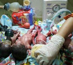 Satu dari Empat Bayi Kembar yang Lahir di RSUD Lasinrang Tak Terselamatkan