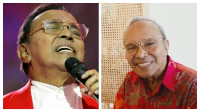 Riwayat Penyakit Bob Tutupoly, Penyanyi Legendaris yang Meninggal Dunia di Usia 82 Tahun