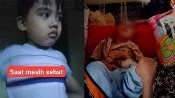 Bocah 7 Tahun Diduga Dianiaya Orangtua hingga Hilang Ingatan, Badannya Kurus dan Memprihatinkan