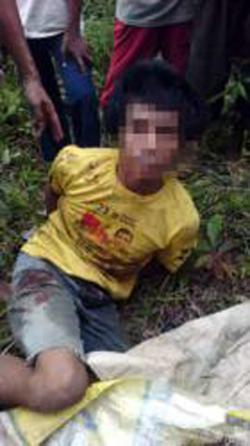 Alami Gangguan Jiwa, Hendi Hanya Diobati Dukun Kampung