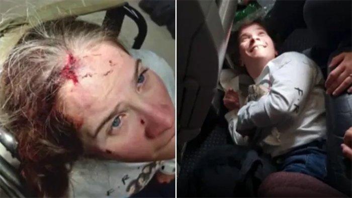 Penumpang Penyandang Cacat Jatuh Saat Transfer Penerbangan di Bandara, Alami Sejumlah Luka di Kepala