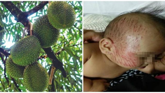 Ibu dan Bayi Dilarikan ke Rumah Sakit setelah Tertimpa Durian, Kondisi sang Anak Tak Separah Ibunya