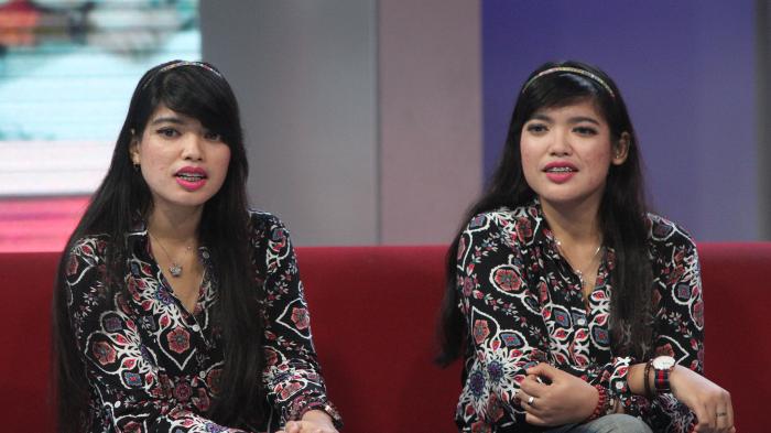 Sosok kembar Yuliana-Yuliani yang menjadi pemberitaan hangat pada 1987 alias 29 tahun silam karena dilahirkan sebagai bayi kembar siam