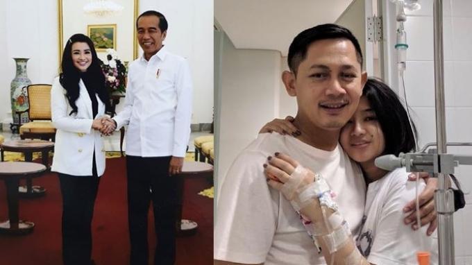 Cerita Fitri Carlina Baru Keluar RS dan Rela Menahan Sakit demi Bertemu Jokowi