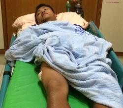 Randi Terkapar Ditembak saat Melawan Pelaku Begal