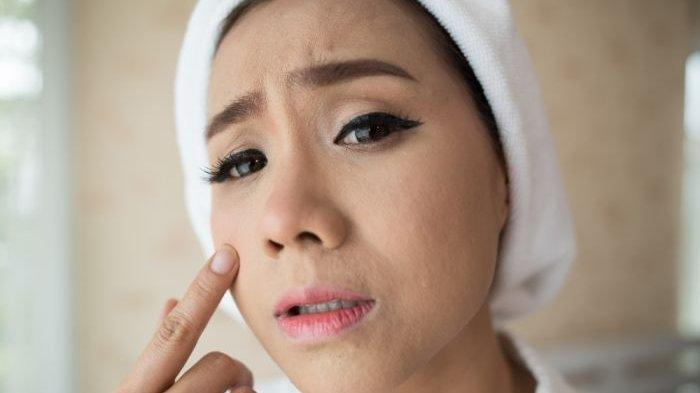 Ilustrasi seseorang yang memiliki permasalahan kulit kering, berikut sederet tips untuk mengatasinya