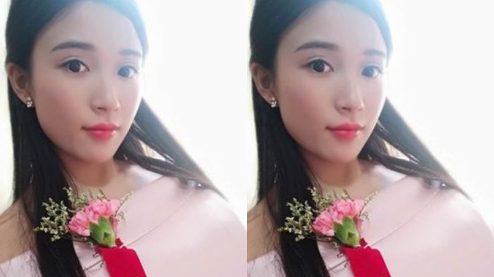 Seorang Wanita Harus Rela Kakinya Diamputasi Usai Menjadi Bridesmaid Selama 2 Hari