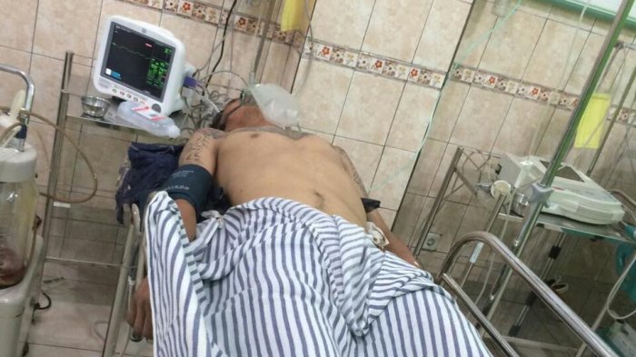 Pencuri Motor yang Diamuk Massa Akhirnya Tewas