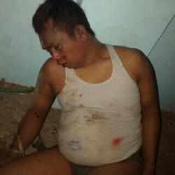 Ketahuan Curi Motor, Wajah Arifin Babak Belur Diamuk Massa