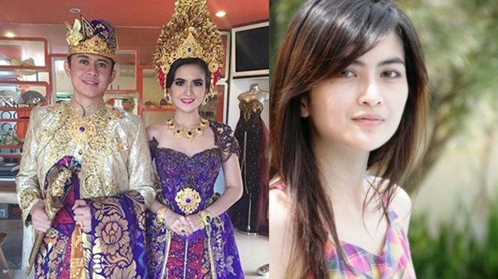 Lahirkan Bayi Kembar setelah 3 Tahun Menikah, Begini Penampilan Terkidini Kadek Devi