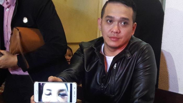 Sambil Menangis, Presenter Kembar Fadli-Fadlan Beberkan Betapa Parahnya Kondisi Sang Adik