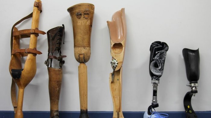 Seorang Pengusaha Kaki Palsu Tawarkan Prosthesis Gratis untuk Korban Ledakan Bom di Surabaya Gratis