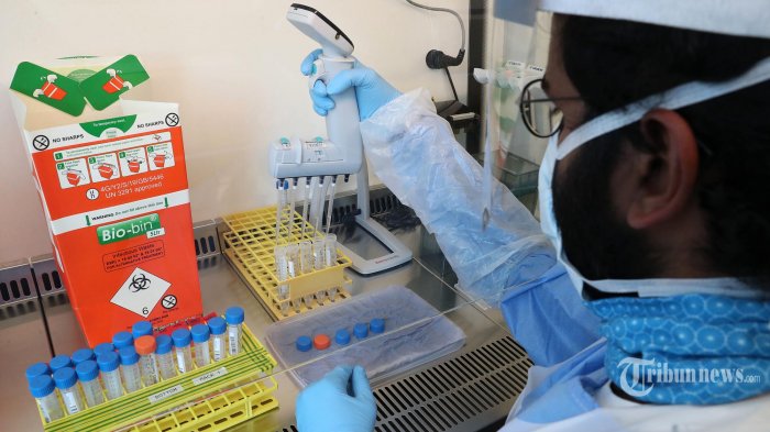 Dokter Ungkap Kondisi Petugas Laboratorium ITD Unair yang Terpapar Covid-19