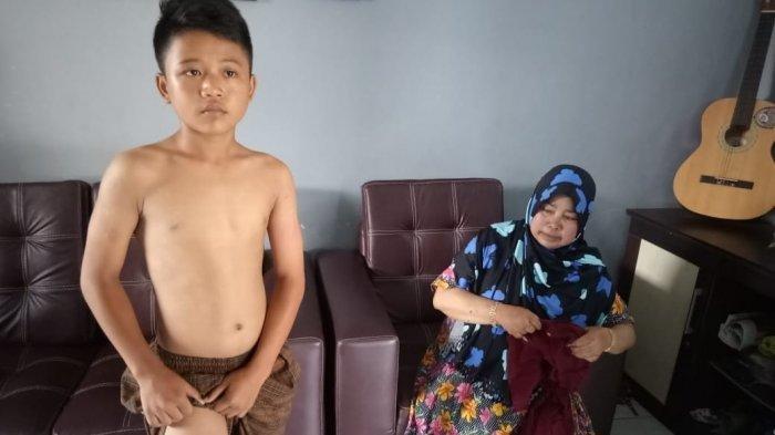 Seorang Murid SD Tewas Disengat Tawon, Tiga Lainnya Luka-luka, Begini Kisahnya