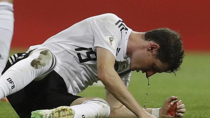 Sebastian Rudy Tak Bisa Tampil di Laga Penentu Jerman