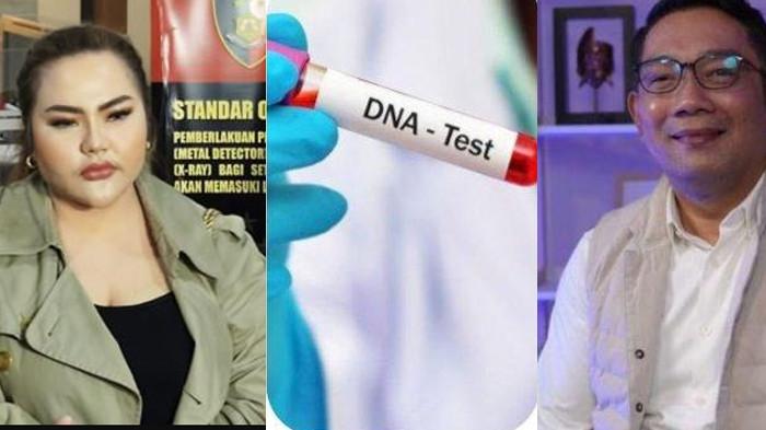 TES DNA - Misteri siapa ayah biologis anak Lisa Mariana sepertinya akan segera terungkap. Tes DNA sudah disetujui Bareskrim. Benarkah Ridwan Kamil?