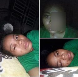 TKW Asal TTS Dianiaya Majikan hingga Mata Kanannya Buta