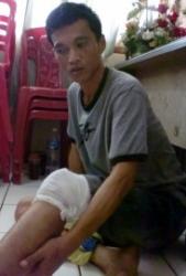 Jualan Sepi Dedi Alih Profesi Jadi Copet
