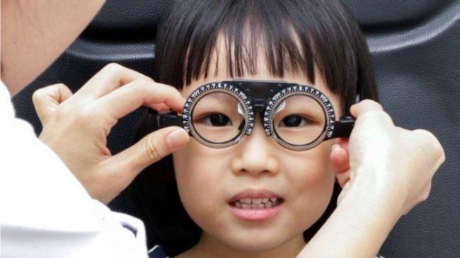 Kenali Gejala Mata Minus pada Anak Sejak Dini dan Cara Mengatasinya