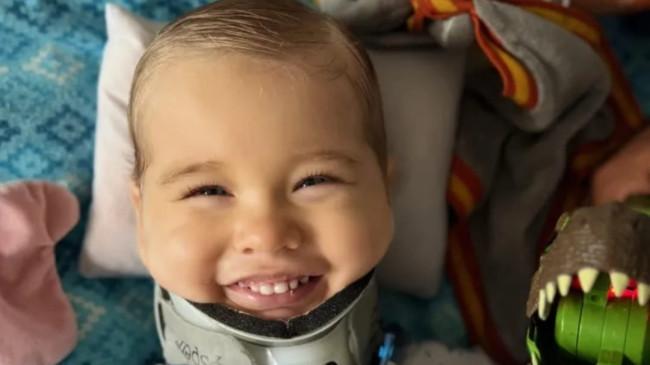 Kisah Oliver Staub,  Bocah Asal Jerman yang Bangkit dari Cedera Parah, Kini Bisa Tersenyum Lagi