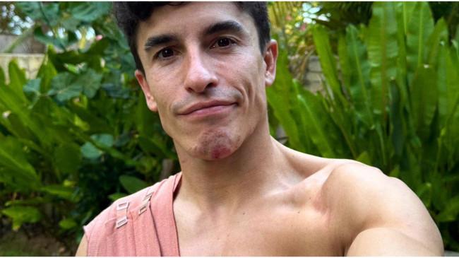 Komentar Marc Marquez soal Cederanya di MotoGP Mandalika 2025, Baby Alien Berbalut Perban
