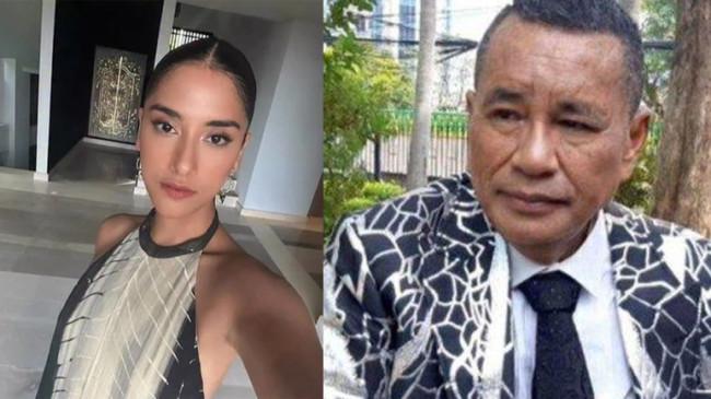 Hotman Paris Cari Sabrina Alatas Lalu Singgung Kegantengan, Sindir Hamish Daud?
