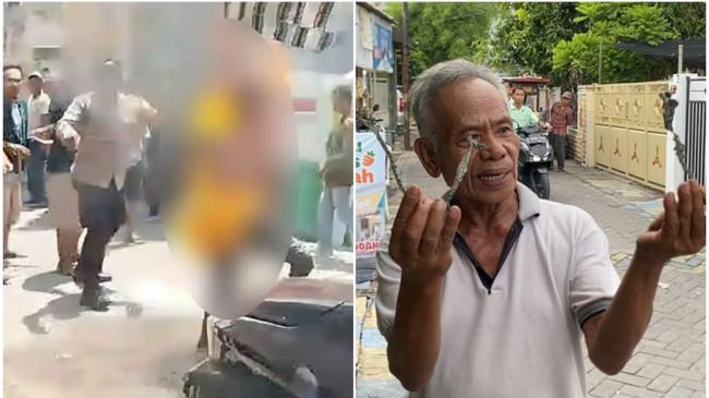 Sosok Rizki, Viral Pencuri Terbakar di Surabaya, Berawal Polisi Lepaskan Ikatan Pakai Korek Api