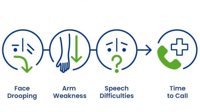 Kenali Gejala Stroke Sejak Dini, Risiko Kematian dan Disabilitas Bisa Dikurangi