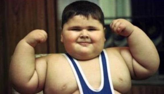 Apakah Anak Kecil Boleh Diet? Ini Penjelasan Dokter Cara Aman Atasi Obesitas Anak