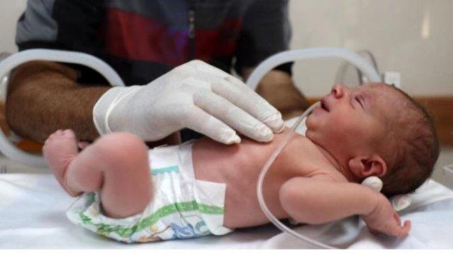 Dampak Pneumonia pada Otak Bayi, Bisa Berisiko Turunkan Potensi Kecerdasan di Masa Depan