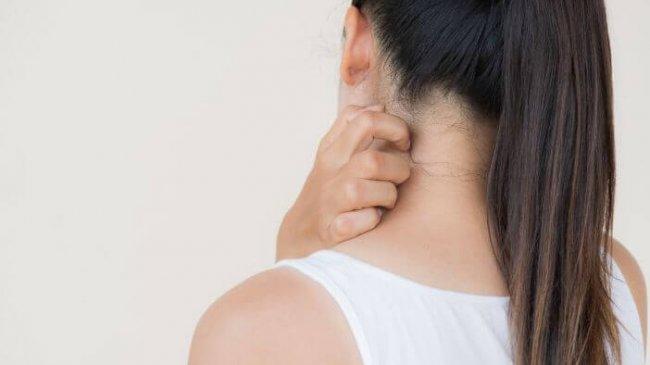 Cegah Penularan Cacar Air, Dokter Anak Rekomendasikan Cara Isolasi yang Benar 