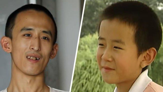 KISAH Zhang Xinyang, Anak Jenius Kuliah di Usia 10 Tahun, Begini Kondisinya Saat Usia 30