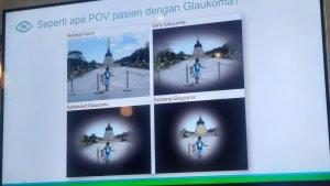 Glaukoma-1-14032025.jpg