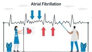 atrial-fibrilasi_2.jpg