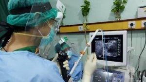 endoscopic-ultrasound-guided-radiofrequency-ablation.jpg