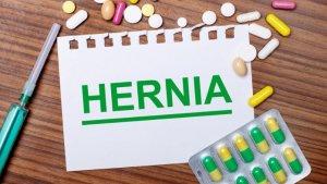 ilustrasi-hernia-3.jpg