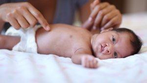 kasus-bibir-sumbing-dan-celah-langit-terbuka-pada-bayi.jpg