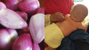 kata-dokter-tentang-penggunaan-bawang-merah-untuk-kerokan-anak.jpg