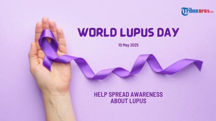 Lupus Bisa Picu Trombosit Turun hingga Sering Disangka DBD atau Malaria, Ini Bedanya