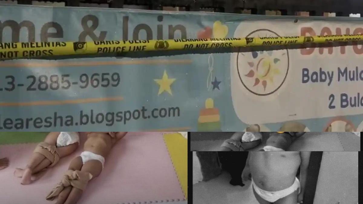 Kondisi Anak Korban Kekerasan di Daycare Little Aresha Jogja, Alami Luka-luka hingga Pneumonia