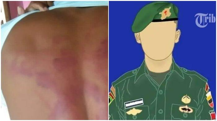 Kronologi-Pria-di-NTT-Diduga-Dianiaya-4-Oknum-TNI-Korban-Digebuki-Pakai-Kabel-Depan-Istri.jpg